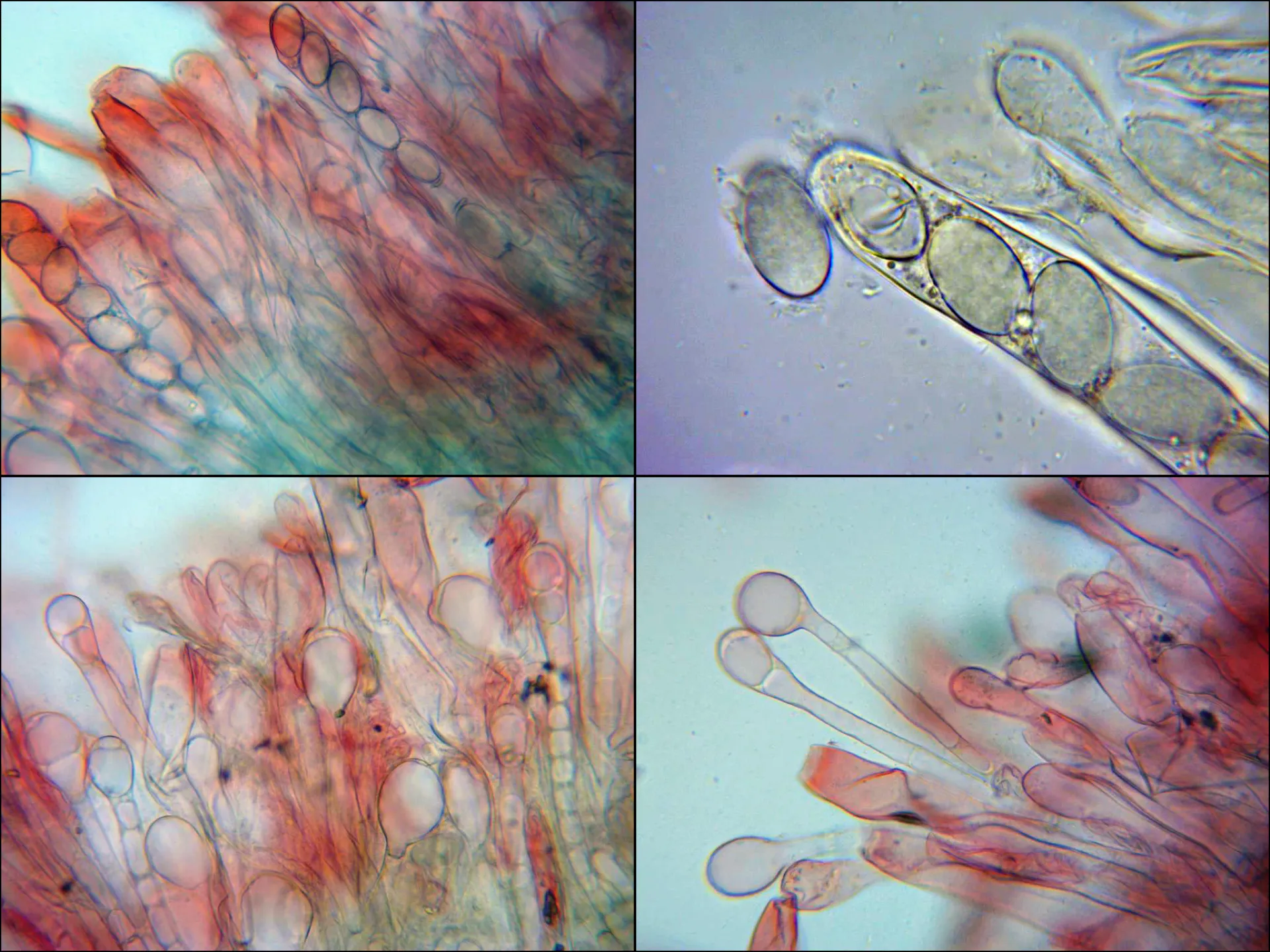Microscopía de Morchella semilibera - 10 -  Ascas y parafisos